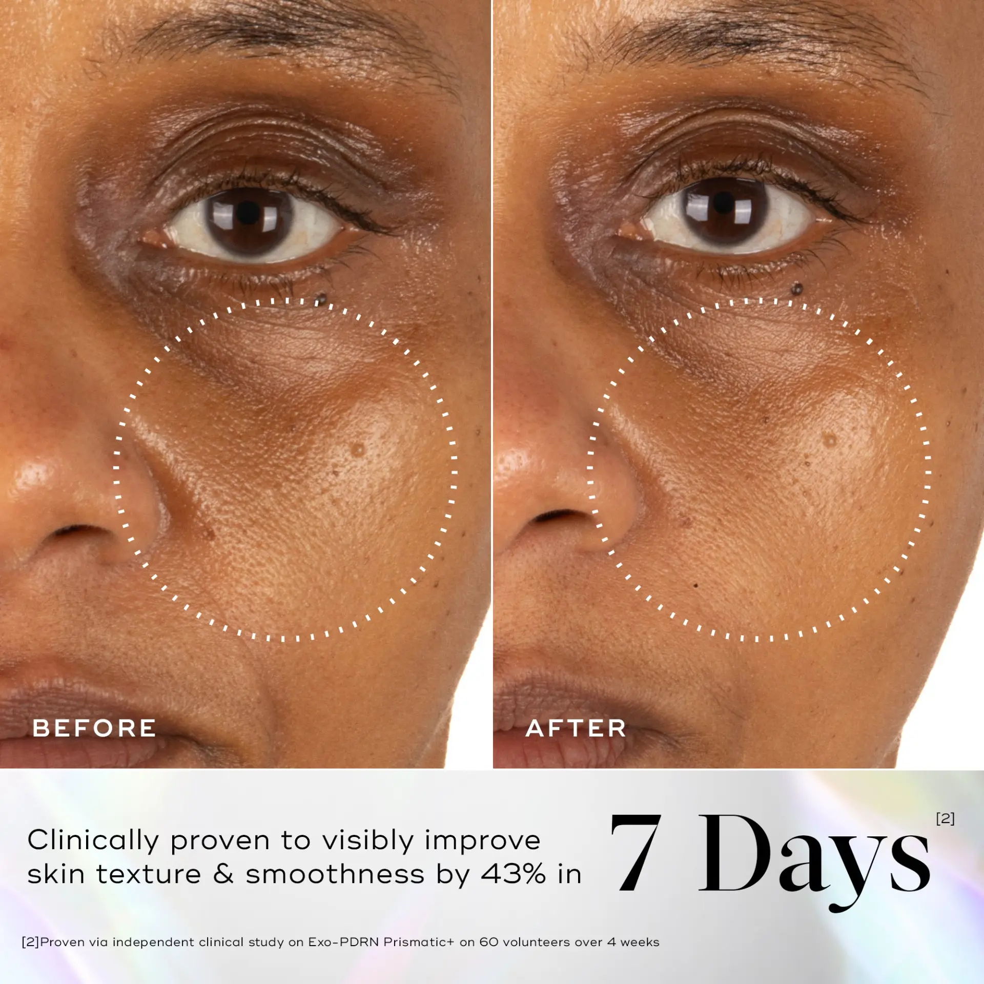 Before and after: skin texture and smoothness improved by 43% in 7 days